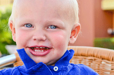 Pediatric Dental Care in Carlsbad