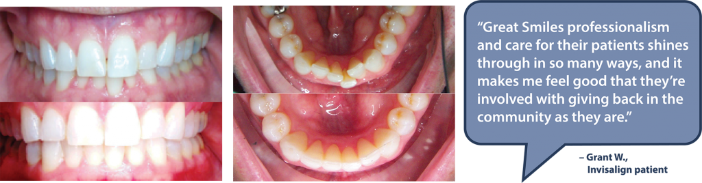 Pediatric Emergency Dentist in Solana Beach